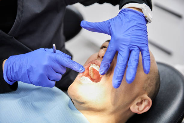 Best Emergency Gum Treatment in International Falls, MN