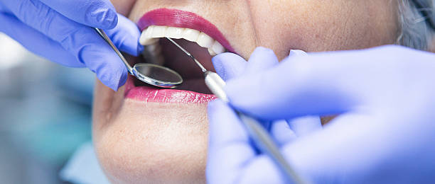 Best Urgent Care for Lost Fillings or Crowns in International Falls, MN