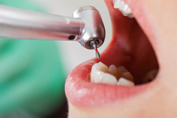 Best Emergency Root Canal Treatment in International Falls, MN